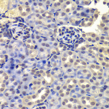 LSM4 Antibody - Immunohistochemistry of paraffin-embedded mouse kidney tissue.