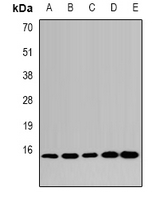 LSM4 Antibody - Western blot analysis of LSm4 expression in HepG2 (A); MCF7 (B); mouse kidney (C); mouse heart (D); rat liver (E) whole cell lysates.