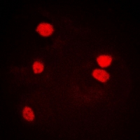 LSM4 Antibody - Immunofluorescent analysis of LSm4 staining in U2OS cells. Formalin-fixed cells were permeabilized with 0.1% Triton X-100 in TBS for 5-10 minutes and blocked with 3% BSA-PBS for 30 minutes at room temperature. Cells were probed with the primary antibody in 3% BSA-PBS and incubated overnight at 4 deg C in a humidified chamber. Cells were washed with PBST and incubated with a DyLight 594-conjugated secondary antibody (red) in PBS at room temperature in the dark.