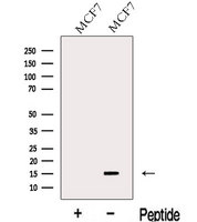 LSM4 Antibody - Western blot analysis of extracts of MCF-7 cells using LSM4 antibody. The lane on the left was treated with blocking peptide.