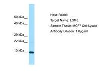 LSM5 Antibody -  This image was taken for the unconjugated form of this product. Other forms have not been tested.