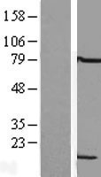 LSM6 Protein - Western validation with an anti-DDK antibody * L: Control HEK293 lysate R: Over-expression lysate