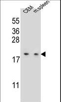LSM7 Antibody - LSM7 Antibody western blot of CEM cell line and mouse spleen tissue lysates (35 ug/lane). The LSM7 antibody detected the LSM7 protein (arrow).