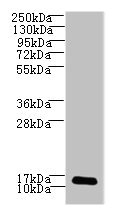 LSM7 Antibody - Western blot All lanes: LSM7 antibody at 3µg/ml + HepG2 whole cell lysate Secondary Goat polyclonal to rabbit IgG at 1/10000 dilution Predicted band size: 12 kDa Observed band size: 12 kDa
