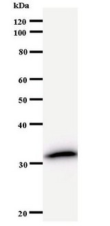 LSM8 / NAA38 Antibody - Western blot of immunized recombinant protein using LSM8 antibody.