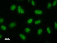 LSM8 / NAA38 Antibody - Immunostaining analysis in HeLa cells. HeLa cells were fixed with 4% paraformaldehyde and permeabilized with 0.1% Triton X-100 in PBS. The cells were immunostained with anti-LSM8 mAb.
