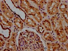 LSM8 / NAA38 Antibody - Immunohistochemistry Dilution at 1:600 and staining in paraffin-embedded human kidney tissue performed on a Leica BondTM system. After dewaxing and hydration, antigen retrieval was mediated by high pressure in a citrate buffer (pH 6.0). Section was blocked with 10% normal Goat serum 30min at RT. Then primary antibody (1% BSA) was incubated at 4°C overnight. The primary is detected by a biotinylated Secondary antibody and visualized using an HRP conjugated SP system.