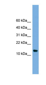 LSM8 / NAA38 Antibody - NAA38 / LSM8 antibody Western blot of OVCAR-3 cell lysate. This image was taken for the unconjugated form of this product. Other forms have not been tested.