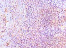 LSP1 Antibody - Immunohistochemistry of paraffin-embedded human tonsil using antibody at 1:100 dilution.