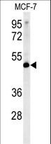 LSP1 Antibody - LSP1 Antibody western blot of MCF-7 cell line lysates (35 ug/lane). The LSP1 antibody detected the LSP1 protein (arrow).