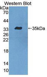 LSP1 Antibody - Western blot of LSP1 antibody.