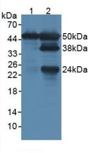 LSP1 Antibody - Western Blot; Sample: Lane1: Rat Lung Tissue; Lane2: Rat Spleen Tissue.
