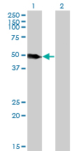 LSP1 Antibody - Western Blot analysis of LSP1 expression in transfected 293T cell line by LSP1 monoclonal antibody (M07), clone 1C4.Lane 1: LSP1 transfected lysate(37.2 KDa).Lane 2: Non-transfected lysate.