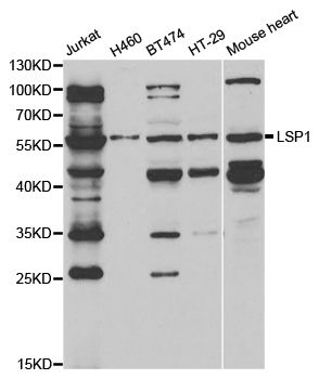 LSP1 Antibody - Western blot analysis of extracts of various cell lines, using LSP1 antibody at 1:1000 dilution. The secondary antibody used was an HRP Goat Anti-Rabbit IgG (H+L) at 1:10000 dilution. Lysates were loaded 25ug per lane and 3% nonfat dry milk in TBST was used for blocking. An ECL Kit was used for detection and the exposure time was 90s.