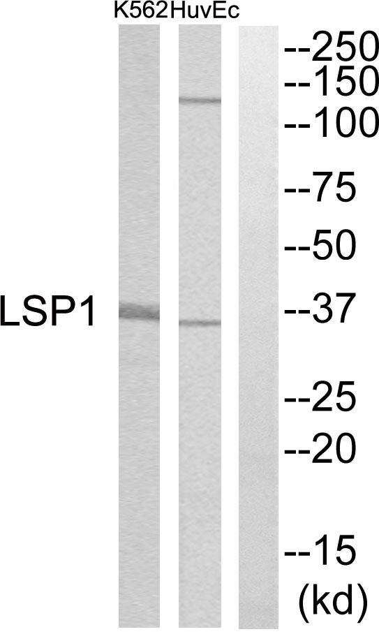 LSP1 Antibody - Western blot analysis of extracts from HuvEc cells and K562 cells, using LSP1 antibody.