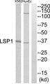 LSP1 Antibody - Western blot analysis of extracts from HuvEc cells and K562 cells, using LSP1 antibody.
