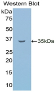 LSR / LISCH7 Antibody - Western blot of recombinant LSR / LISCH7.  This image was taken for the unconjugated form of this product. Other forms have not been tested.