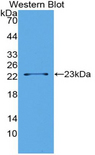 LSR / LISCH7 Antibody - Western blot of recombinant LSR / LISCH7.  This image was taken for the unconjugated form of this product. Other forms have not been tested.