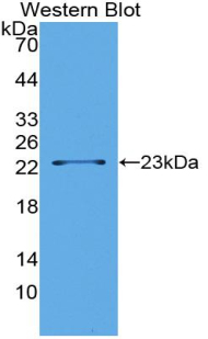 LSR / LISCH7 Antibody - Western blot of recombinant LSR / LISCH7.  This image was taken for the unconjugated form of this product. Other forms have not been tested.