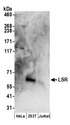 LSR / LISCH7 Antibody - Detection of human LSR by western blot. Samples: Whole cell lysate (50 µg) from HeLa, HEK293T, and Jurkat cells prepared using RIPA lysis buffer. Antibodies: Affinity purified rabbit anti-LSR antibody used for WB at 0.1 µg/ml. Detection: Chemiluminescence with an exposure time of 3 minutes.