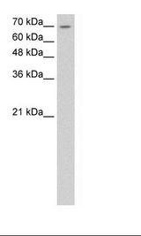 LSR / LISCH7 Antibody - HepG2 Cell Lysate.  This image was taken for the unconjugated form of this product. Other forms have not been tested.