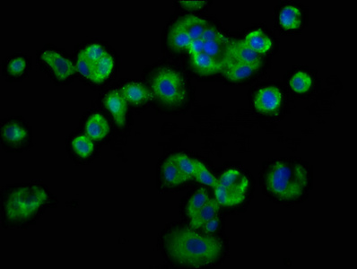 LSR / LISCH7 Antibody - Immunofluorescence staining of HepG2 cells at a dilution of 1:133, counter-stained with DAPI. The cells were fixed in 4% formaldehyde, permeabilized using 0.2% Triton X-100 and blocked in 10% normal Goat Serum. The cells were then incubated with the antibody overnight at 4 °C.The secondary antibody was Alexa Fluor 488-congugated AffiniPure Goat Anti-Rabbit IgG (H+L) .