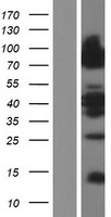 LSR / LISCH7 Protein - Western validation with an anti-DDK antibody * L: Control HEK293 lysate R: Over-expression lysate
