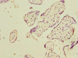 LSS Antibody - Immunohistochemistry of paraffin-embedded human placenta tissue at dilution 1:100