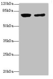 LSS Antibody - Western blot All lanes: LSS antibody at 0.76µg/ml Lane 1: PC-3 whole cell lysate Lane 2: Hela whole cell lysate Secondary Goat polyclonal to rabbit IgG at 1/10000 dilution Predicted band size: 84, 75, 83 kDa Observed band size: 84 kDa