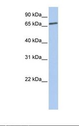 LSS Antibody - Fetal liver lysate. Antibody concentration: 1.0 ug/ml. Gel concentration: 12%.  This image was taken for the unconjugated form of this product. Other forms have not been tested.