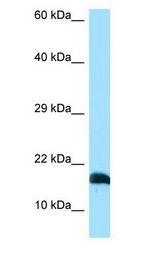 LST1 Antibody - LST1 / LST-1 antibody Western Blot of 293T.  This image was taken for the unconjugated form of this product. Other forms have not been tested.