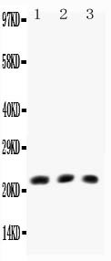 LTA / TNF Beta Antibody - TNF beta antibody All Western blot. All lanes: Anti-TNF beta at 0.5 ug/ml. Lane 1: HELA Whole Cell Lysate at 40 ug. Lane 2: MCF-7 Whole Cell Lysate at 40 ug. Lane 3: COLO320 Whole Cell Lysate at 40 ug. Predicted band size: 22 kD. Observed band size: 22 kD.