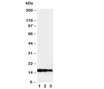 LTA / TNF Beta Antibody - Western blot testing of TNF beta antibody and Lane 1: recombinant human protein 10ng; 2: 5ng; 3: 2.5ng