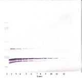 LTA / TNF Beta Antibody - Anti-Human TNF-ß Western Blot Reduced
