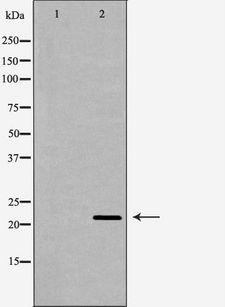LTA / TNF Beta Antibody - Western blot analysis of extracts of human spleen using LTA antibody. The lane on the left is treated with the antigen-specific peptide.