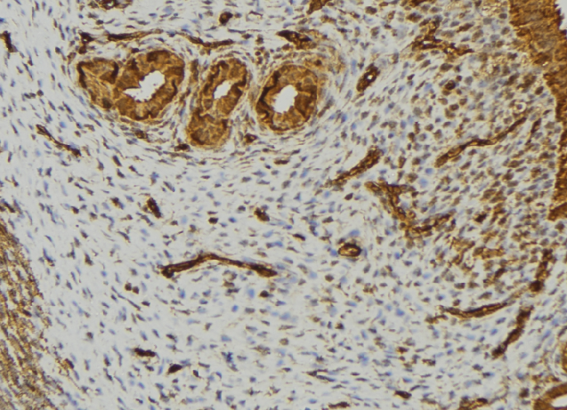 LTA / TNF Beta Antibody - 1:100 staining human uterus tissue by IHC-P. The sample was formaldehyde fixed and a heat mediated antigen retrieval step in citrate buffer was performed. The sample was then blocked and incubated with the antibody for 1.5 hours at 22°C. An HRP conjugated goat anti-rabbit antibody was used as the secondary.