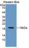 LTA4H / LTA4 Antibody - Western blot of LTA4H / LTA4 antibody.