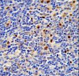 LTA4H / LTA4 Antibody - Formalin-fixed and paraffin-embedded human lymph tissue reacted with LTA4H Antibody , which was peroxidase-conjugated to the secondary antibody, followed by DAB staining. This data demonstrates the use of this antibody for immunohistochemistry; clinical relevance has not been evaluated.