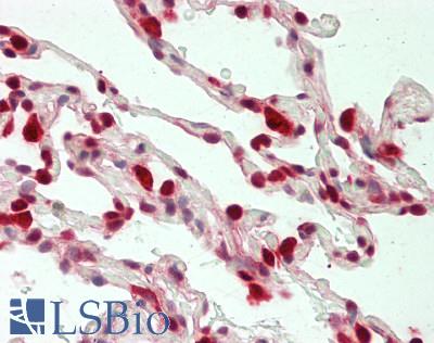 LTA4H / LTA4 Antibody - Human Lung: Formalin-Fixed, Paraffin-Embedded (FFPE)