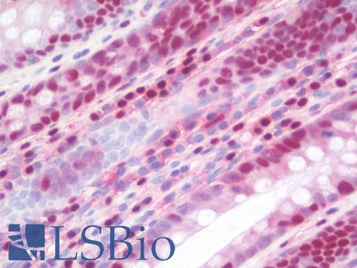 LTA4H / LTA4 Antibody - Anti-LTA4H / LTA4 antibody IHC staining of human colon. Immunohistochemistry of formalin-fixed, paraffin-embedded tissue after heat-induced antigen retrieval. Antibody concentration 10 ug/ml.