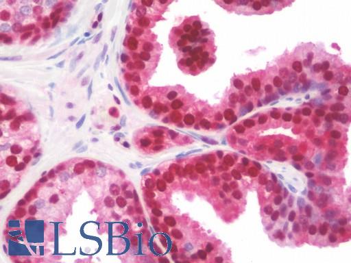 LTA4H / LTA4 Antibody - Anti-LTA4H / LTA4 antibody IHC staining of human prostate. Immunohistochemistry of formalin-fixed, paraffin-embedded tissue after heat-induced antigen retrieval.