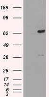 LTA4H / LTA4 Antibody - HEK293T cells were transfected with the pCMV6-ENTRY control (Left lane) or pCMV6-ENTRY LTA4H (Right lane) cDNA for 48 hrs and lysed. Equivalent amounts of cell lysates (5 ug per lane) were separated by SDS-PAGE and immunoblotted with anti-LTA4H.