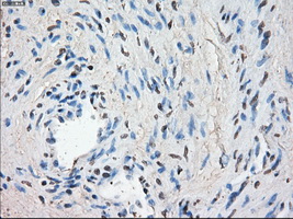 LTA4H / LTA4 Antibody - Immunohistochemical staining of paraffin-embedded prostate tissue using anti-LTA4H mouse monoclonal antibody. (Dilution 1:50).