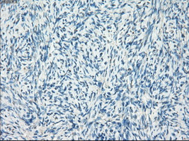 LTA4H / LTA4 Antibody - Immunohistochemical staining of paraffin-embedded Ovary tissue using anti-LTA4H mouse monoclonal antibody. (Dilution 1:50).