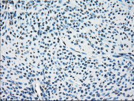 LTA4H / LTA4 Antibody - Immunohistochemical staining of paraffin-embedded endometrium tissue using anti-LTA4H mouse monoclonal antibody. (Dilution 1:50).
