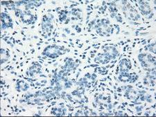 LTA4H / LTA4 Antibody - IHC of paraffin-embedded breast tissue using anti-LTA4H mouse monoclonal antibody. (Dilution 1:50).