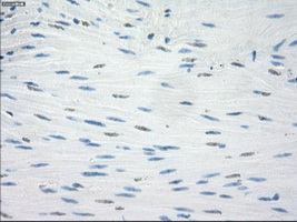 LTA4H / LTA4 Antibody - IHC of paraffin-embedded colon tissue using anti-LTA4H mouse monoclonal antibody. (Dilution 1:50).