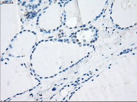 LTA4H / LTA4 Antibody - IHC of paraffin-embedded thyroid tissue using anti-LTA4H mouse monoclonal antibody. (Dilution 1:50).