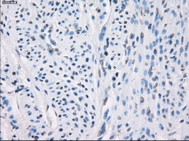LTA4H / LTA4 Antibody - IHC of paraffin-embedded endometrium tissue using anti-LTA4H mouse monoclonal antibody. (Dilution 1:50).