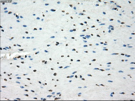 LTA4H / LTA4 Antibody - IHC of paraffin-embedded colon tissue using anti-LTA4H mouse monoclonal antibody. (Dilution 1:50).